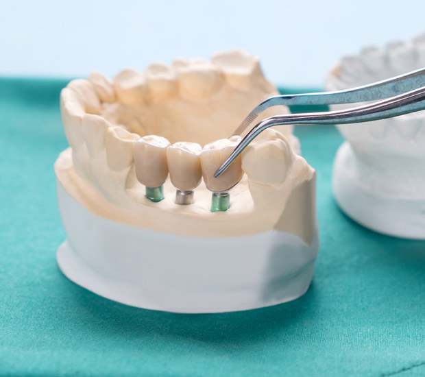 Marietta Prosthodontist